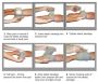 Изр. бандаж 6" Hemorrhage Control Bandage (две подушки)