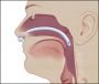 Teleflex Medical назофарингінальна трубка Nasopharyngeal Airway